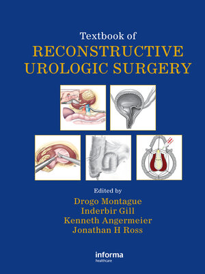cover image of Textbook of Reconstructive Urologic Surgery